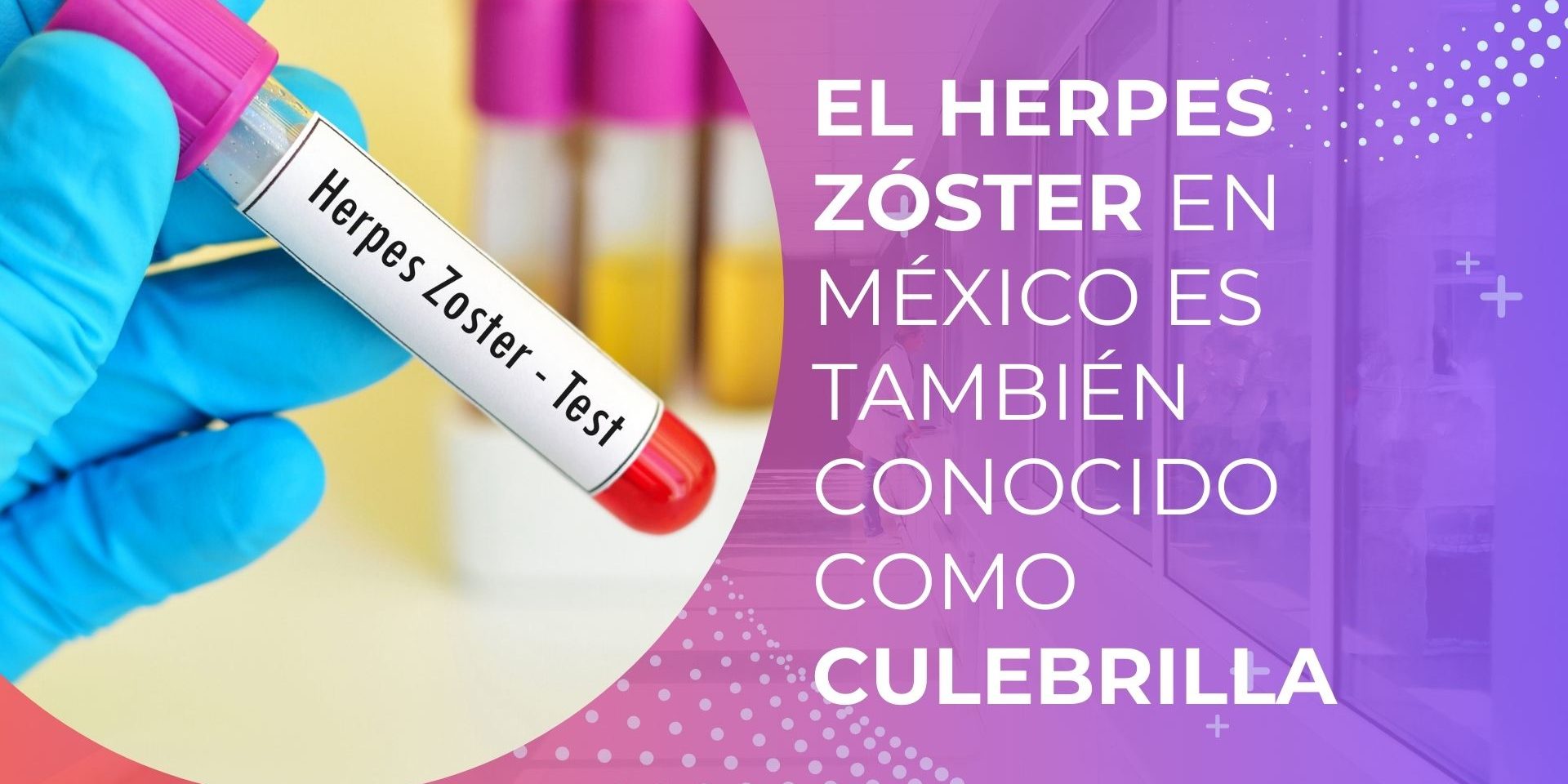 herpes-zoster-mexico